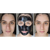 Shills - Carbon Blackhead Remover Facial Mask